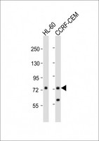 KIF22 / OBP Antibody - All lanes: Anti-KIF22 Antibody (Center) at 1:1000 dilution. Lane 1: HL-60 whole cell lysates. Lane 2: CCRF-CEM whole cell lysates Lysates/proteins at 20 ug per lane. Secondary Goat Anti-Rabbit IgG, (H+L), Peroxidase conjugated at 1:10000 dilution. Predicted band size: 73 kDa. Blocking/Dilution buffer: 5% NFDM/TBST.