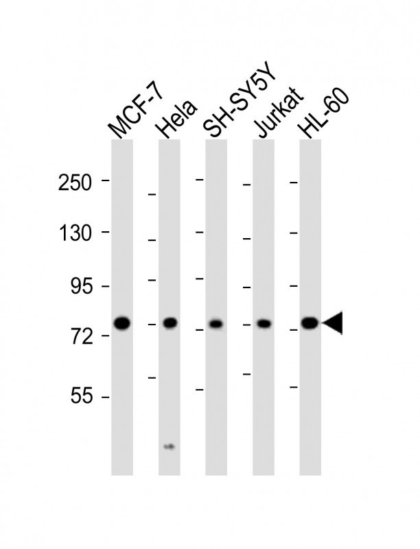 KIF22 / OBP Antibody - All lanes : Anti-KIF22 Antibody at 1:2000 dilution Lane 1: MCF-7 whole cell lysates Lane 2: HeLa whole cell lysates Lane 3: SH-SY5Y whole cell lysates Lane 4: Jurkat whole cell lysates Lane 5: HL-60 whole cell lysates Lysates/proteins at 20 ug per lane. Secondary Goat Anti-Rabbit IgG, (H+L), Peroxidase conjugated at 1/10000 dilution Predicted band size : 73 kDa Blocking/Dilution buffer: 5% NFDM/TBST.