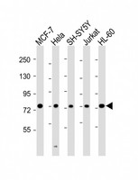 KIF22 / OBP Antibody - All lanes : Anti-KIF22 Antibody at 1:2000 dilution Lane 1: MCF-7 whole cell lysates Lane 2: HeLa whole cell lysates Lane 3: SH-SY5Y whole cell lysates Lane 4: Jurkat whole cell lysates Lane 5: HL-60 whole cell lysates Lysates/proteins at 20 ug per lane. Secondary Goat Anti-Rabbit IgG, (H+L), Peroxidase conjugated at 1/10000 dilution Predicted band size : 73 kDa Blocking/Dilution buffer: 5% NFDM/TBST.