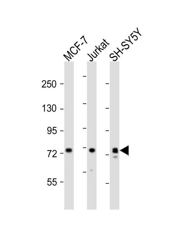 KIF22 / OBP Antibody - All lanes : Anti-KIF22 Antibody at 1:2000 dilution Lane 1: MCF-7 whole cell lysates Lane 2: Jurkat whole cell lysates Lane 3: SH-SY5Y whole cell lysates Lysates/proteins at 20 ug per lane. Secondary Goat Anti-Rabbit IgG, (H+L), Peroxidase conjugated at 1/10000 dilution Predicted band size : 73 kDa Blocking/Dilution buffer: 5% NFDM/TBST.