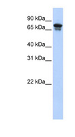 KIF22 / OBP Antibody - KIF22 antibody Western blot of Transfected 293T cell lysate. This image was taken for the unconjugated form of this product. Other forms have not been tested.