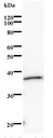 KIF22 / OBP Antibody - Western blot of immunized recombinant protein using KIF22 antibody.