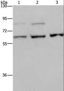 KIF22 / OBP Antibody - Western blot analysis of A431, MCF-7 and HeLa cell, using KIF22 Polyclonal Antibody at dilution of 1:200.