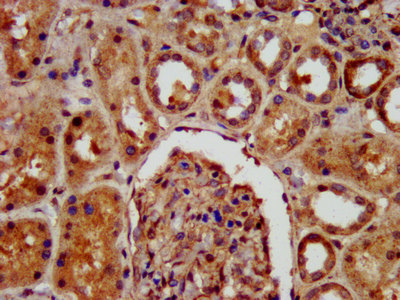 KIF22 / OBP Antibody - Immunohistochemistry image at a dilution of 1:400 and staining in paraffin-embedded human kidney tissue performed on a Leica BondTM system. After dewaxing and hydration, antigen retrieval was mediated by high pressure in a citrate buffer (pH 6.0) . Section was blocked with 10% normal goat serum 30min at RT. Then primary antibody (1% BSA) was incubated at 4 °C overnight. The primary is detected by a biotinylated secondary antibody and visualized using an HRP conjugated SP system.