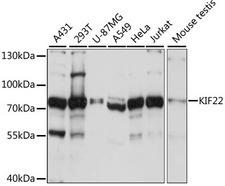 KIF22 / OBP Antibody - Western blot analysis of extracts of various cell lines, using KIF22 antibody at 1:1000 dilution. The secondary antibody used was an HRP Goat Anti-Rabbit IgG (H+L) at 1:10000 dilution. Lysates were loaded 25ug per lane and 3% nonfat dry milk in TBST was used for blocking. An ECL Kit was used for detection and the exposure time was 3s.