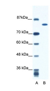KIF23 / MKLP1 Antibody - KIF23 / MKLP1 antibody Western blot of Jurkat lysate. This image was taken for the unconjugated form of this product. Other forms have not been tested.