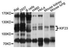 KIF23 / MKLP1 Antibody - Western blot analysis of extracts of various cell lines, using KIF23 antibody at 1:1000 dilution. The secondary antibody used was an HRP Goat Anti-Rabbit IgG (H+L) at 1:10000 dilution. Lysates were loaded 25ug per lane and 3% nonfat dry milk in TBST was used for blocking. An ECL Kit was used for detection and the exposure time was 30s.