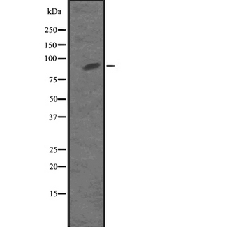 KIF23 / MKLP1 Antibody - Western blot analysis of KIF23 expression in MKLP1 transfected 293T cells lysate. The lane on the left is treated with the antigen-specific peptide.