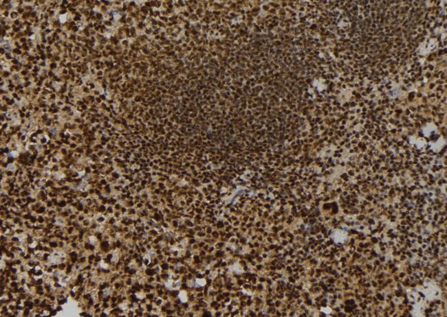 KIF23 / MKLP1 Antibody - 1:100 staining mouse spleen tissue by IHC-P. The sample was formaldehyde fixed and a heat mediated antigen retrieval step in citrate buffer was performed. The sample was then blocked and incubated with the antibody for 1.5 hours at 22°C. An HRP conjugated goat anti-rabbit antibody was used as the secondary.