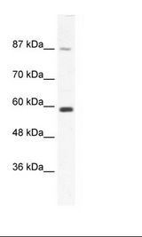 KIF23 / MKLP1 Antibody - Jurkat Cell Lysate.  This image was taken for the unconjugated form of this product. Other forms have not been tested.