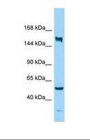 KIF24 Antibody - Western blot of Human MDA-MB-435S. KIF24 antibody dilution 1.0 ug/ml.  This image was taken for the unconjugated form of this product. Other forms have not been tested.