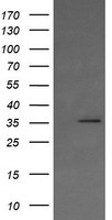 KIF25 Antibody - HEK293T cells were transfected with the pCMV6-ENTRY control (Left lane) or pCMV6-ENTRY KIF25 (Right lane) cDNA for 48 hrs and lysed. Equivalent amounts of cell lysates (5 ug per lane) were separated by SDS-PAGE and immunoblotted with anti-KIF25.
