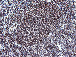 KIF25 Antibody - IHC of paraffin-embedded Human tonsil using anti-KIF25 mouse monoclonal antibody.