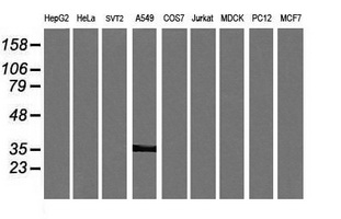 KIF25 Antibody - Western blot of extracts (35ug) from 9 different cell lines by using anti-KIF25 monoclonal antibody (HepG2: human; HeLa: human; SVT2: mouse; A549: human; COS7: monkey; Jurkat: human; MDCK: canine; PC12: rat; MCF7: human).