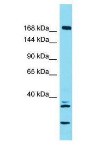 KIF27 Antibody - KIF27 antibody Western Blot of Large Intestine Tumor. Antibody dilution: 1 ug/ml.  This image was taken for the unconjugated form of this product. Other forms have not been tested.