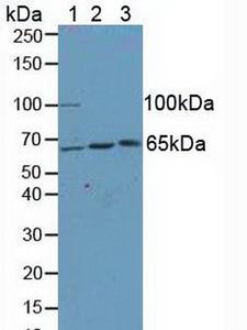 KIF2A Antibody - Western Blot; Sample: Lane1: Human Hela Cells; Lane2: Rat Brain Tissue; Lane3: Rat Spinal Cord Tissue.