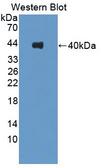 KIF2A Antibody - Western blot of KIF2A antibody.
