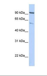 KIF2A Antibody - HepG2 cell lysate. Antibody concentration: 1.0 ug/ml. Gel concentration: 12%.  This image was taken for the unconjugated form of this product. Other forms have not been tested.