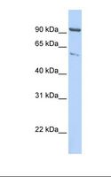 KIF2A Antibody - HepG2 cell lysate. Antibody concentration: 1.0 ug/ml. Gel concentration: 12%.  This image was taken for the unconjugated form of this product. Other forms have not been tested.