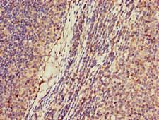 KIF2A Antibody - Immunohistochemistry of paraffin-embedded human lymph node tissue at dilution of 1:100