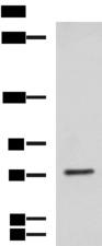 KIF2A Antibody - Western blot analysis of NIH/3T3 cell lysate  using KIF2A Polyclonal Antibody at dilution of 1:850