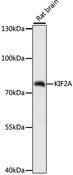 KIF2A Antibody - Western blot analysis of extracts of rat brain using KIF2A Polyclonal Antibody at dilution of 1:1000.
