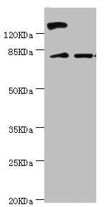 KIF2B Antibody - Western blot All Lanes:KIF2B antibody at 3.59ug/ml Lane 1:mouse lung tissue Lane 2:293T whole cell lysate Secondary Goat polyclonal to rabbit at 1/10000 dilution Predicted band size: 76kDa Observed band size: 80kDa,150kDa