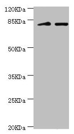 KIF2B Antibody - Western blot All lanes: KIF2B antibody at 3.59µg/ml Lane 1: Mouse lung tissue Lane 2: 293T whole cell lysate Secondary Goat polyclonal to rabbit IgG at 1/10000 dilution Predicted band size: 76 kDa Observed band size: 80, 150 kDa