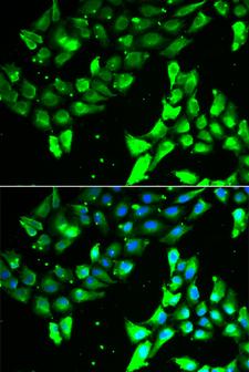 KIF2B Antibody - Immunofluorescence analysis of A549 cells using KIF2B Polyclonal Antibody.