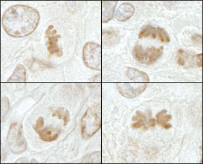 KIF2C / MCAK Antibody - Detection of Mouse MCAK by Immunohistochemistry. Sample: FFPE section of mouse hybridoma tumor. Antibody: Affinity purified rabbit anti-MCAK used at a dilution of 1:250. Epitope Retrieval Buffer-High pH (IHC-101J) was substituted for Epitope Retrieval Buffer-Reduced pH.