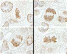 KIF2C / MCAK Antibody - Detection of Mouse MCAK by Immunohistochemistry. Sample: FFPE section of mouse hybridoma tumor. Antibody: Affinity purified rabbit anti-MCAK used at a dilution of 1:250. Epitope Retrieval Buffer-High pH (IHC-101J) was substituted for Epitope Retrieval Buffer-Reduced pH.