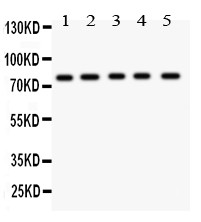KIF2C / MCAK Antibody - MCAK antibody Western blot. All lanes: Anti MCAK at 0.5 ug/ml. Lane 1: Mouse Testis Tissue Lysate at 50 ug. Lane 2: HELA Whole Cell Lysate at 40 ug. Lane 3: MM231 Whole Cell Lysate at 40 ug. Lane 4: MM453 Whole Cell Lysate at 40 ug. Lane 5: SKOV Whole Cell Lysate at 40 ug. Predicted band size: 81 kD. Observed band size: 81 kD.