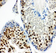 KIF2C / MCAK Antibody - MCAK antibody IHC-paraffin: Mouse Testis Tissue.