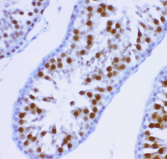 KIF2C / MCAK Antibody - MCAK antibody IHC-paraffin: Rat Testis Tissue.