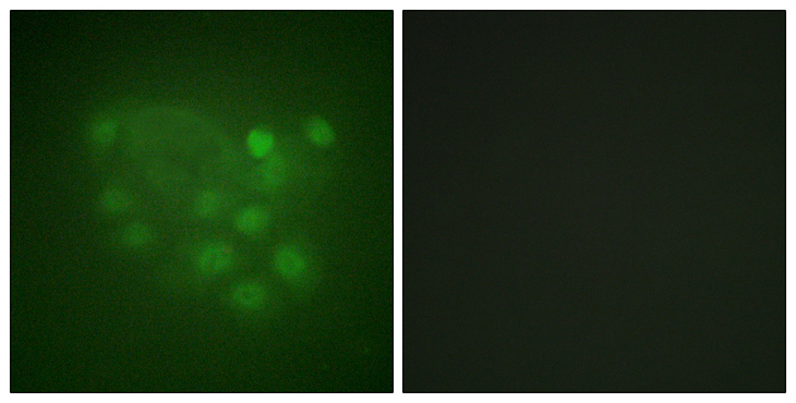 KIF2C / MCAK Antibody - Immunofluorescence analysis of A549 cells, using KIF2C Antibody. The picture on the right is blocked with the synthesized peptide.