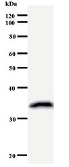 KIF2C / MCAK Antibody - Western blot of immunized recombinant protein using KIF2C antibody.