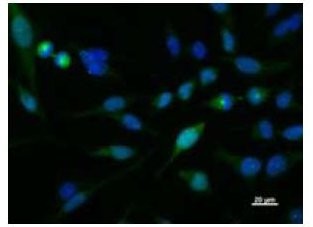 KIF2C / MCAK Antibody - Immunofluorescent staining using KIF2C antibody. Immunostaining analysis in HeLa cells. HeLa cells were fixed with 4% paraformaldehyde and permeabilized with 0.01% Triton-X100 in PBS. The cells were immunostained with anti-KIF2C antibody. Nuclear was stained with Hoechst (blue fluorescence).