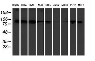 KIF2C / MCAK Antibody - Western blot of extracts (35ug) from 9 different cell lines by using anti-KIF2C monoclonal antibody.