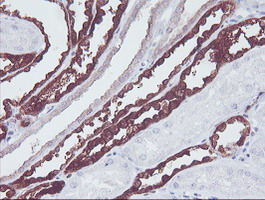 KIF2C / MCAK Antibody - IHC of paraffin-embedded Human Kidney tissue using anti-KIF2C mouse monoclonal antibody. (Heat-induced epitope retrieval by 10mM citric buffer, pH6.0, 100C for 10min).