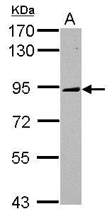KIF2C / MCAK Antibody - Sample (30 ug of whole cell lysate) A: K562 7.5% SDS PAGE KIF2C / MCAK antibody diluted at 1:1000