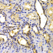 KIF2C / MCAK Antibody - Immunohistochemistry of paraffin-embedded human kidney tissue.