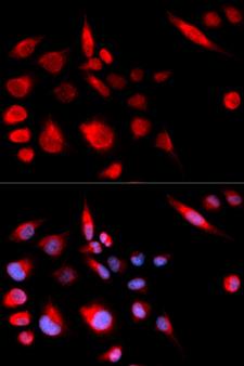 KIF2C / MCAK Antibody - Immunofluorescence analysis of U20S cells.