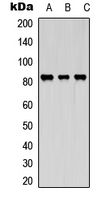 KIF2C / MCAK Antibody - Western blot analysis of KIF2C (pS95) expression in Jurkat (A); A431 (B); HepG2 (C) whole cell lysates.