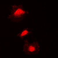 KIF2C / MCAK Antibody - Immunofluorescent analysis of KIF2C (pS95) staining in Jurkat cells. Formalin-fixed cells were permeabilized with 0.1% Triton X-100 in TBS for 5-10 minutes and blocked with 3% BSA-PBS for 30 minutes at room temperature. Cells were probed with the primary antibody in 3% BSA-PBS and incubated overnight at 4 deg C in a humidified chamber. Cells were washed with PBST and incubated with a DyLight 594-conjugated secondary antibody (red) in PBS at room temperature in the dark. DAPI was used to stain the cell nuclei (blue).