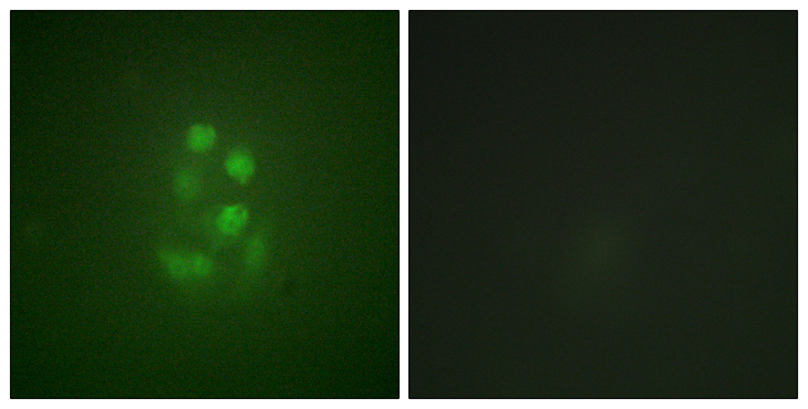 KIF2C / MCAK Antibody - Immunofluorescence analysis of A549 cells, using KIF2C (Phospho-Ser95) Antibody. The picture on the right is blocked with the phospho peptide.