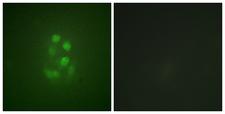 KIF2C / MCAK Antibody - Immunofluorescence analysis of A549 cells, using KIF2C (Phospho-Ser95) Antibody. The picture on the right is blocked with the phospho peptide.