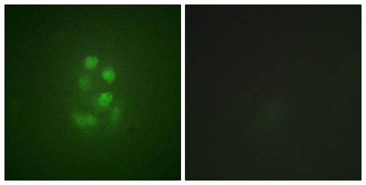 KIF2C / MCAK Antibody - P-peptide - + Immunofluorescence analysis of A549 cells, using KIF2C (Phospho-Ser95) antibody.