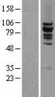 KIF2C / MCAK Protein - Western validation with an anti-DDK antibody * L: Control HEK293 lysate R: Over-expression lysate