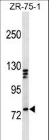 KIF3A Antibody - KIF3A Antibody western blot of ZR-75-1 cell line lysates (35 ug/lane). The KIF3A antibody detected the KIF3A protein (arrow).
