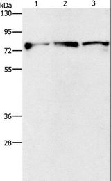 KIF3A Antibody - Western blot analysis of Mouse brain and human fetal brain tissue, human brain malignant glioma tissue, using KIF3A Polyclonal Antibody at dilution of 1:500.